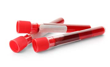 Blood-Tests
